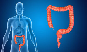 previeni il tumore al colon